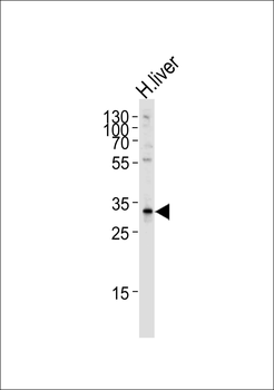 SULT2A Antibody (C-term)