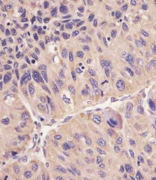 ACSL4 (FACL4) Antibody (Center)