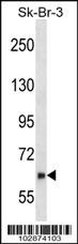 NYREN18 Antibody (N-term)