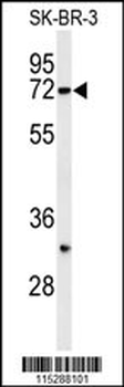 HRD1 Antibody (N-term)