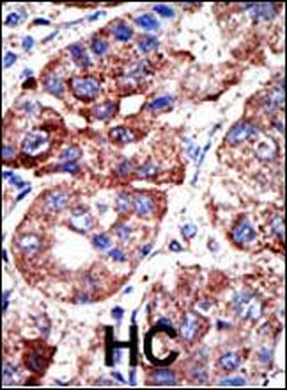 SQSTM1 (p62) Antibody (C-term)