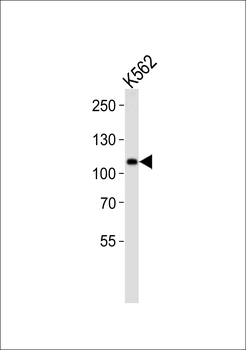 Mib1/Mindbomb Antibody (N-term)