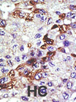 UBCH9 Antibody (N-term)