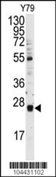 UBCH9 Antibody (N-term)