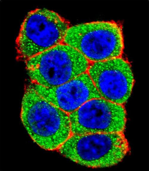 UBE3A Antibody (C-term)