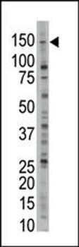 USP28 Antibody (N-term)