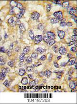 UCHL3 Antibody (C-term)