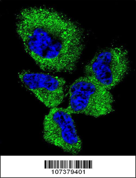 UCHL1 Antibody (C-term)