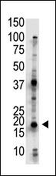 UBE2G2 Antibody (N-term)