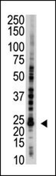 E2EPF Antibody (C-term)