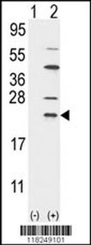 UBE2C Antibody (N-term G25)