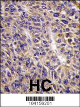 UBE2L6 Antibody (N-term)