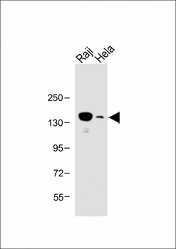 UBE4B Antibody (N-term)