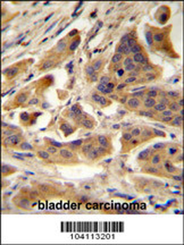 RBCK1 (UBCE7IP3) Antibody (N-term)