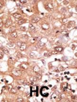 BMP9 (GDF2) Antibody (N-term)