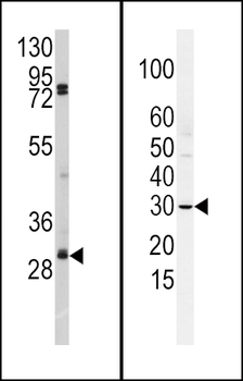 SLUG Antibody (N-term K9)