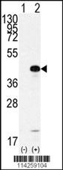 SOX2 Antibody (C265)