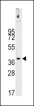 PDX1 Antibody (T11)