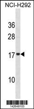 VAMP4 Antibody (Center)