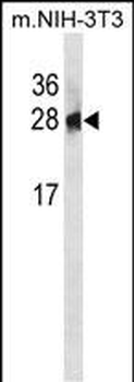 PSPH Antibody (N-term)