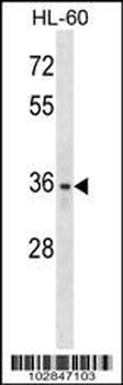 LYVE1 (XLKD1) Antibody (C-term)