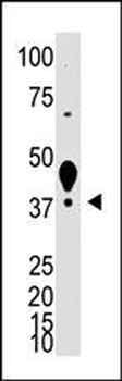 XLKD1 Antibody (N-term)