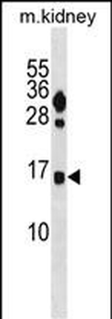 FUNDC2 Antibody (C-term)