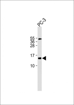 FUNDC2 Antibody (C-term)