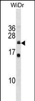 ISCU Antibody (C-term)
