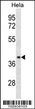 Chemokine Receptor D6 (CCBP2) Antibody (C-term)