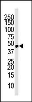 Chemokine Receptor D6 (CCBP2) Antibody (C-term)