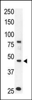 Chemokine Receptor D6 (CCBP2) Antibody (N-term)