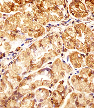 POLDIP3 Antibody (N-term)