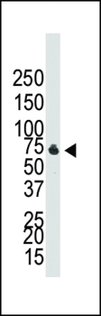 BMPR1B Antibody (C-term)