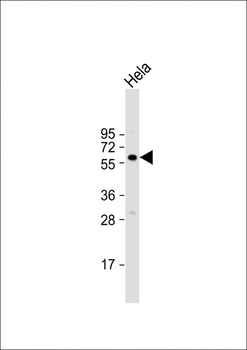 BMPR1A Antibody (Center C180)