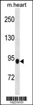 PDE8B Antibody (Center)