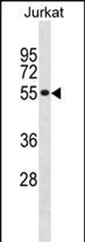 SF3A2 Antibody (Center)