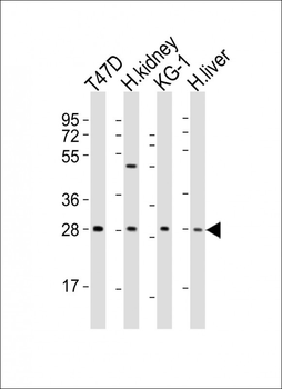 HAVCR2 Antibody (Center)