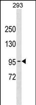 POLK Antibody (Center)