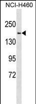 SYNJ2 Antibody (Center)
