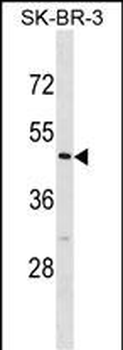 CASQ2 Antibody (Center)