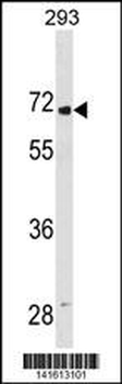LINGO2 Antibody(Center)