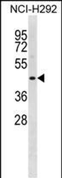 STAC2 Antibody(N-term)