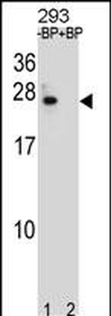 BCL2 Antibody (Center)