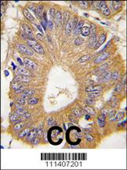 EIF4EBP1 Antibody (T69)