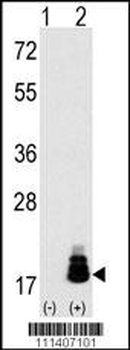 EIF4EBP1 Antibody (T69)