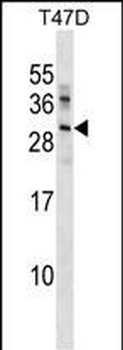 UBE2R2 Antibody (Center)