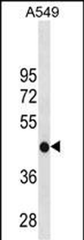 GATM Antibody(C-term)