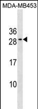 BCL2 Antibody(Center)