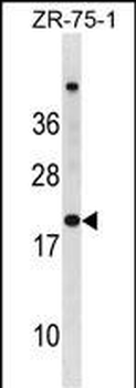 CDKN2A Antibody(N-term S8)